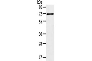 Gel: 8 % SDS-PAGE,Lysate: 40 μg,Primary antibody: ABIN7192909(TRIM47 Antibody) at dilution 1/300 dilution,Secondary antibody: Goat anti rabbit IgG at 1/8000 dilution,Exposure time: 1 minute (TRIM47 抗体)