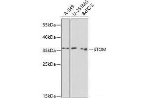Western blot analysis of extracts of various cell lines using STOM Polyclonal Antibody at dilution of 1:1000. (Stomatin 抗体)