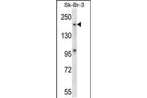Western blot analysis in SK-BR-3 cell line lysates (35ug/lane). (MAP4K4 抗体  (AA 506-534))