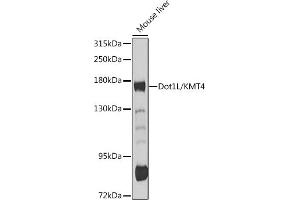 Western blot analysis of extracts of mouse liver, using Dot1L/KMT4 antibody (ABIN6130310, ABIN6139773, ABIN6139777 and ABIN6215149) at 1:1000 dilution.