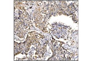 IHC analysis of Caspase-9/CASP9 using anti-Caspase-9/CASP9 antibody (ABIN7600340).