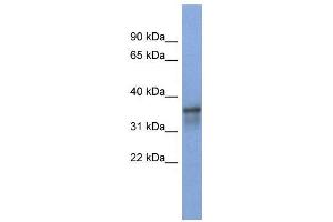 WB Suggested Anti-RBM9  Antibody Titration: 0. (RBM9 抗体  (Middle Region))