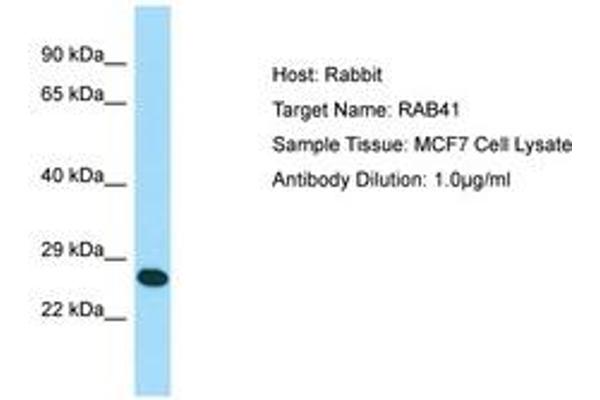 RAB41 抗体  (N-Term)