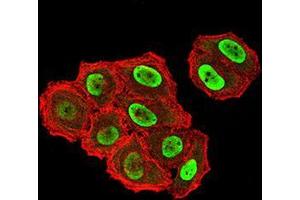 Immunocytochemistry (ICC) image for anti-ZFP91 Zinc Finger Protein (ZFP91) (AA 162-304) antibody (ABIN5542699)