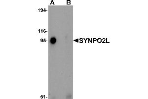 Western Blotting (WB) image for anti-Synaptopodin 2-Like (SYNPO2L) (N-Term) antibody (ABIN1031594) (SYNPO2L 抗体  (N-Term))