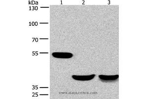 Western blot analysis of Mouse brain and human fetal muscle tissue, mouse heart tissue, using CABLES1 Polyclonal Antibody at dilution of 1:650