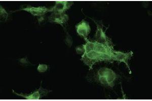 Immunofluorescence - anti-RFP Ab in 293HEK cells transfected with RFP at 1/50 dilution, cells Were fixed with 4% of PFA (RFP 抗体)