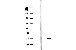 Western blot analysis of lysates from Mouse lung, using Rab9 Antibody at 1/1000 dilution.