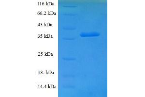 SDS-PAGE (SDS) image for Glucosamine-6-Phosphate Deaminase 1 (GNPDA1) (AA 1-289), (full length) protein (His tag) (ABIN5709599) (GNPDA1 Protein (AA 1-289, full length) (His tag))