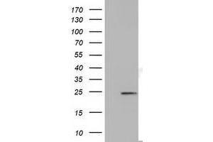 Western Blotting (WB) image for anti-MOB Kinase Activator 3B (MOB3B) antibody (ABIN1499539) (MOBKL2B 抗体)