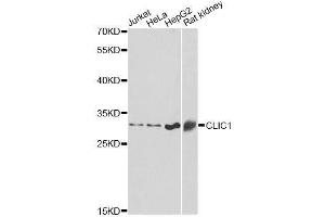 Western blot analysis of extracts of various cell lines, using CLIC1 antibody. (CLIC1 抗体  (AA 42-241))