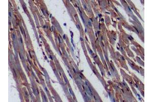 DAB staining on IHC-P; Samples: Rat Cardiac Muscle Tissue