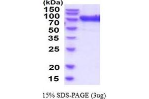 SDS-PAGE (SDS) image for Glucuronidase, beta (GUSB) (AA 23-651) (Active) protein (His tag) (ABIN7529348) (Glucuronidase beta Protein (AA 23-651) (His tag))
