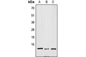 Western blot analysis of SNRPD3 expression in Jurkat (A), mouse brain (B), H9C2 (C) whole cell lysates. (SNRPD3 抗体  (Center))
