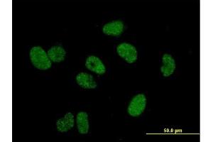 Immunofluorescence of purified MaxPab antibody to TERF1 on HeLa cell. (TRF1 抗体  (AA 1-439))