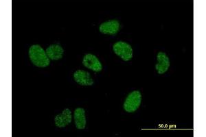 Immunofluorescence of purified MaxPab antibody to TERF1 on HeLa cell. (TRF1 抗体  (AA 1-439))