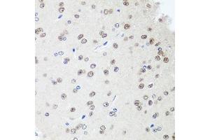 Immunohistochemistry (IHC) image for anti-Sin3A-Associated Protein, 18kDa (SAP18) (AA 21-172) antibody (ABIN1682621)