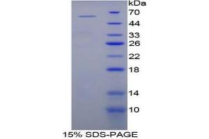 SDS-PAGE analysis of Mouse bACE2 Protein. (BACE2 蛋白)