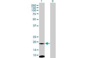 Western Blot analysis of FUNDC2 expression in transfected 293T cell line by FUNDC2 MaxPab polyclonal antibody. (FUNDC2 抗体  (AA 1-189))