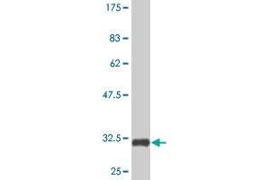 Western Blot detection against Immunogen (32. (TXNDC3/NME8 抗体  (AA 530-586))