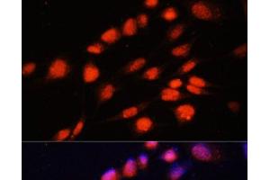 Immunofluorescence analysis of NIH-3T3 cells using ZNF416 Polyclonal Antibody at dilution of 1:100. (ZNF416 抗体)