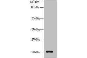 Western blot All lanes: ZBTB8OS antibody at 8 μg/mL + HL60 whole cell lysate Secondary Goat polyclonal to rabbit IgG at 1/10000 dilution Predicted band size: 20, 16 kDa Observed band size: 20 kDa (ZBTB8OS 抗体  (AA 2-136))