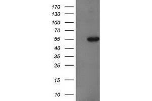 Western Blotting (WB) image for anti-Glucosidase, Beta, Acid 3 (Cytosolic) (GBA3) (AA 1-150), (AA 370-469) antibody (ABIN1490584) (GBA3 抗体  (AA 1-150, AA 370-469))