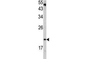 Western Blotting (WB) image for anti-Von Hippel-Lindau Tumor Suppressor, E3 Ubiquitin Protein Ligase (VHL) (AA 181-210) antibody (ABIN3029606)