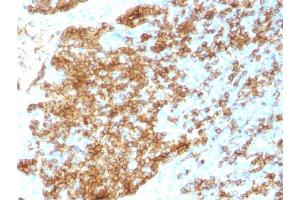 Formalin-fixed, paraffin-embedded human Tonsil stained with CD45RB Rabbit Recombinant Monoclonal Antibody (PTPRC/1783R). (Recombinant CD45 抗体)