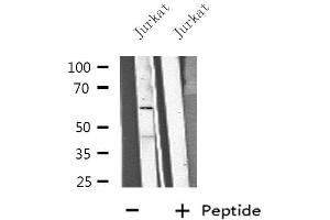 Western blot analysis of extracts from Jurkat cells, using CP1B1 antibody. (CYP1B1 抗体  (Internal Region))
