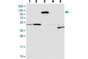 Western blot analysis of Lane 1: RT-4, Lane 2: U-251 MG, Lane 3: Human Plasma, Lane 4: Liver, Lane 5: Tonsil with CNTN5 polyclonal antibody  at 1:250-1:500 dilution. (Contactin 5 抗体)
