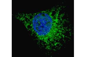 Fluorescent image of  cells stained with (ABIN388463 and ABIN2849510) LC3 (G8A) antibody. (MAP1LC3A 抗体)