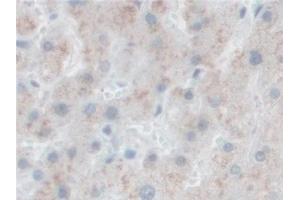 Immunohistochemistry (IHC) image for anti-Proprotein Convertase Subtilisin/kexin Type 1 (PCSK1) (AA 500-738) antibody (ABIN7435748)