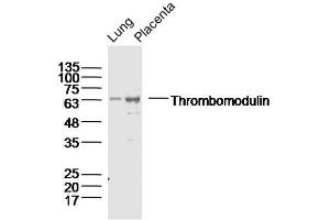 Lane 1: Lung lysates Lane 2: Placenta lysates probed with Thrombomodulin Polyclonal Antibody, Unconjugated  at 1:300 dilution and 4˚C overnight incubation. (Thrombomodulin 抗体  (AA 21-120))