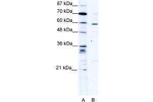 WB Suggested Anti-PDLIM5 Antibody Titration:  1. (PDLIM5 抗体  (Middle Region))