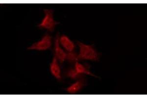 ABIN6276019 staining Hela by IF/ICC. (GPR158 抗体  (N-Term))