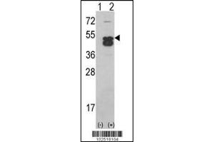 Western blot analysis of CAMK1D using CAMK1D (CAMK1 delta)Antibody using 293 cell lysates (2 ug/lane) either nontransfected (Lane 1) or transiently transfected with the CAMK1D gene (Lane 2). (CAMK1D 抗体  (C-Term))