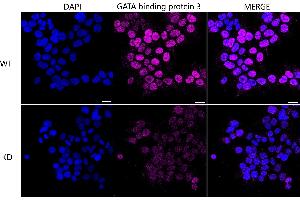 Immunocytochemical staining of HeLa cells using GATA binding protein 3 antibody (ABIN7798695), 1:1,000), Top panel: wild-type (WT), Bottom panal: GATA binding protein 3 shRNA knockdown (KD). (Recombinant GATA3 抗体)