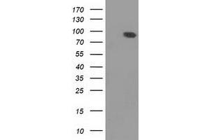 HEK293T cells were transfected with the pCMV6-ENTRY control (Left lane) or pCMV6-ENTRY DLG3 (Right lane) cDNA for 48 hrs and lysed. (DLG3 抗体)