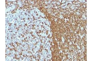 Formalin-fixed, paraffin-embedded human tonsil stained with ICAM3 antibody (ICAM3/1019) (ICAM-3/CD50 抗体)