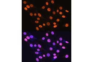 Immunofluorescence analysis of NIH-3T3 cells using hnRNP K Rabbit mAb (ABIN7267634) at dilution of 1:100 (40x lens). (HNRNPK 抗体)