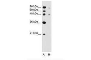 Image no. 1 for anti-Zinc Finger, FYVE Domain Containing 27 (ZFYVE27) (C-Term) antibody (ABIN205048) (ZFYVE27 抗体  (C-Term))