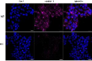Immunocytochemical staining of HeLa cells using Flotillin 1 antibody (ABIN7798631), 1:1,000), Top panel: wild-type (WT), Bottom panal: Flotillin 1 shRNA knockdown (KD). (Recombinant Flotillin 1 抗体)