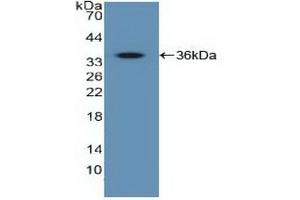 Detection of Recombinant IGF2R, Human using Polyclonal Antibody to Insulin Like Growth Factor 2 Receptor (IGF2R) (IGF2R 抗体  (AA 2167-2442))