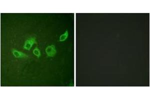 Immunofluorescence analysis of HuvEc cells, using CrkII (Phospho-Tyr221) Antibody. (Crk 抗体  (pTyr221))