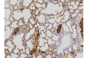 Immunohistochemistry (IHC) image for anti-NADH Dehydrogenase (Ubiquinone) 1 alpha Subcomplex, 8, 19kDa (NDUFA8) (Internal Region) antibody (ABIN6259121)