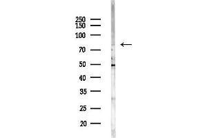 Western blot analysis of lysates from EC304 cells(heat-shock,45 min treatment), using TBX 2/3 Antibody at 1/1000 dilution. (TBX2/3 (Internal Region) 抗体)