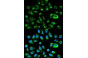 Immunofluorescence analysis of HeLa cell using GAS2 antibody. (GAS2 抗体  (AA 1-100))