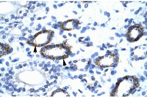 Immunohistochemistry (IHC) image for anti-General Transcription Factor IIF, Polypeptide 2, 30kDa (GTF2F2) (C-Term) antibody (ABIN2777296)
