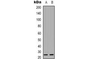 Western blot analysis of CMTM4 expression in Hela (A), A431 (B) whole cell lysates. (CMTM4 抗体)
